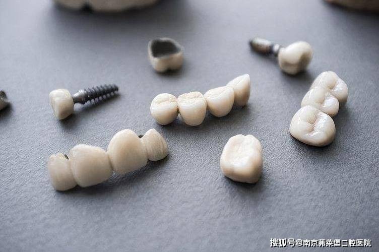 南京无痛全口半口种植牙医院：南京一颗烤瓷牙多少钱一颗